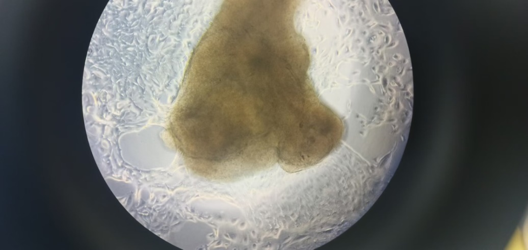 图5A 前列腺组织72小时保存后显微镜观察
